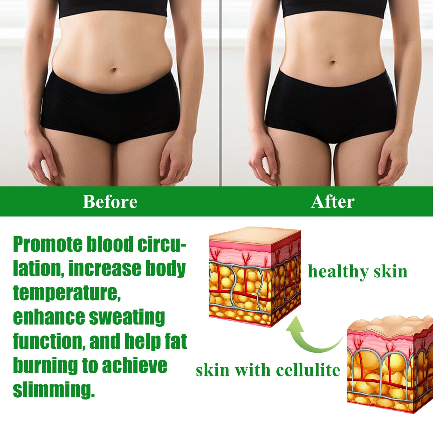 Moxa Leg Lift Paste, Tight Leg Fat, Anti-Orange Peel Shape Lazy People To Create Beautiful Slim Legs