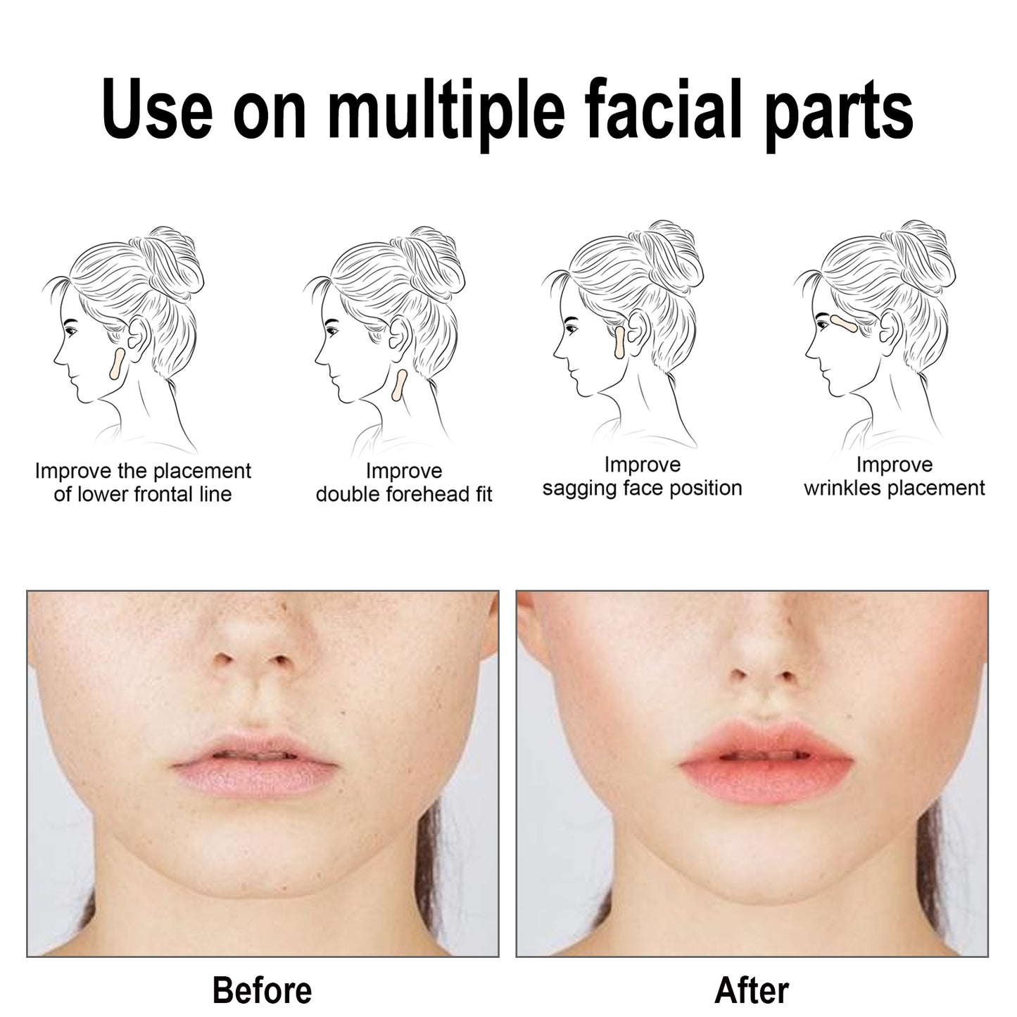 Facial Lifting Patch, Lift Face Double Chin V Face Melon Seed Face Invisible Lifting Patch