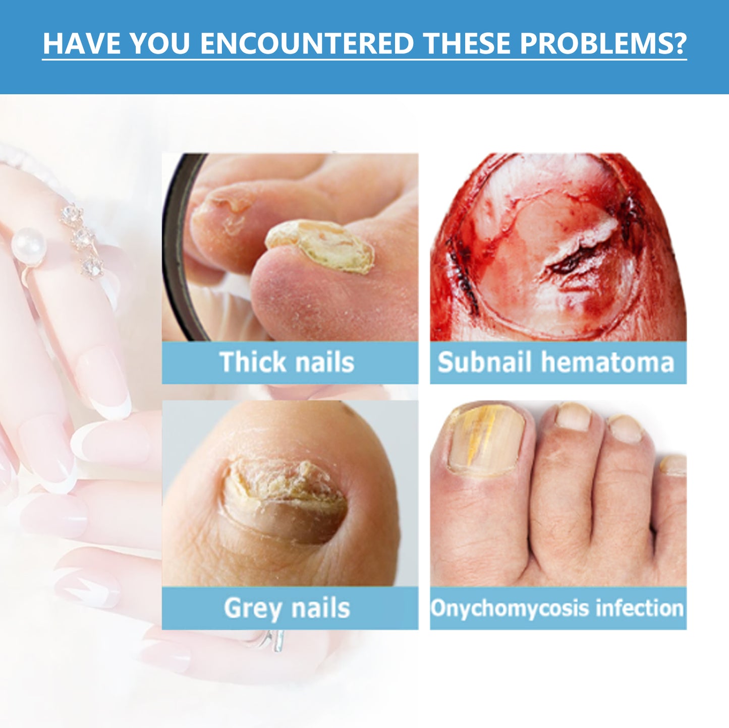 Toenail Fungus Treatment, Repair The Brotherhood Of Nails Rotten Jiasheng Mail This Soft Armour A Detailer