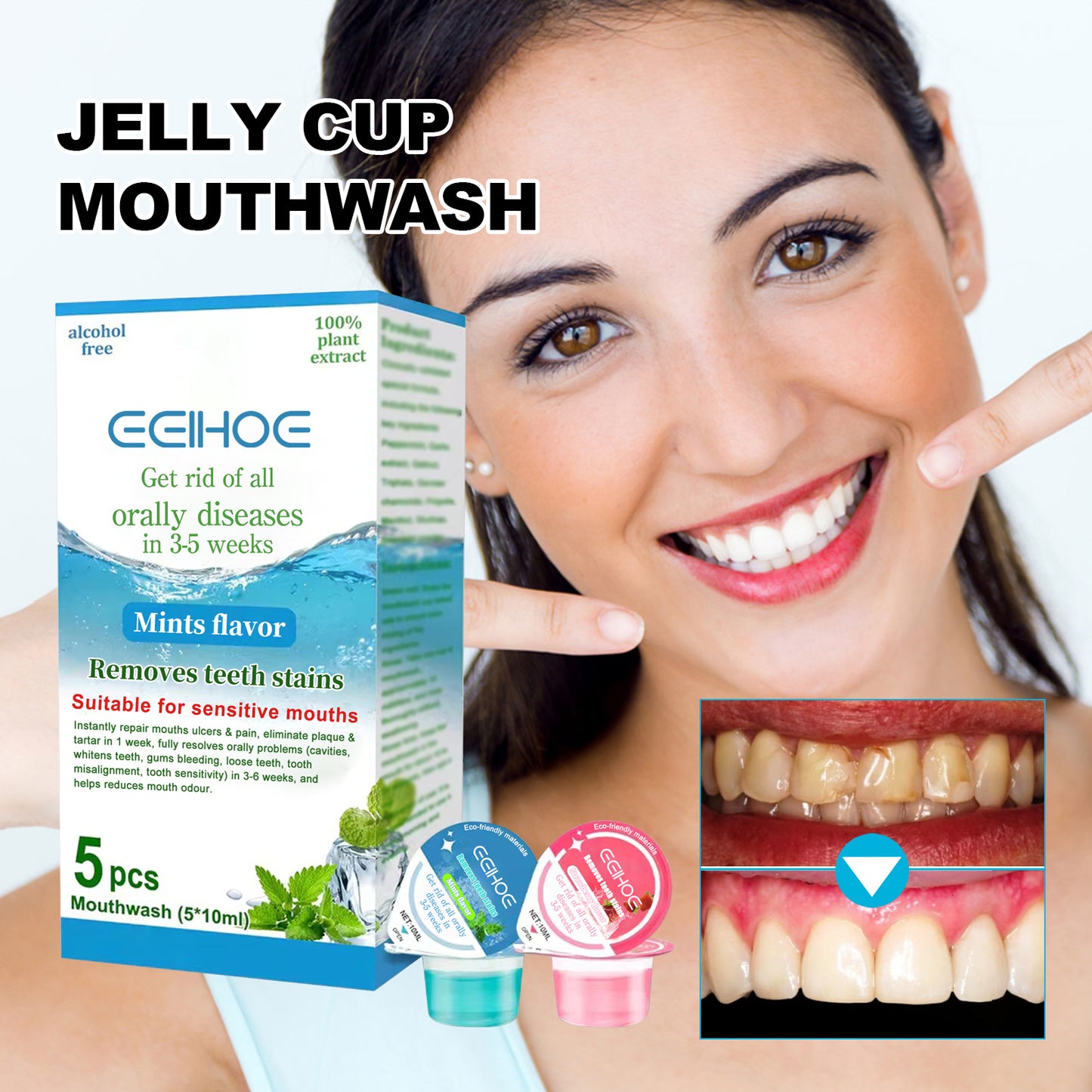 Jelly Cup Mouthwash Cleans Bad Breath, Teeth Stains, Smoke Stains, Brightening Teeth And Refreshing Breath
