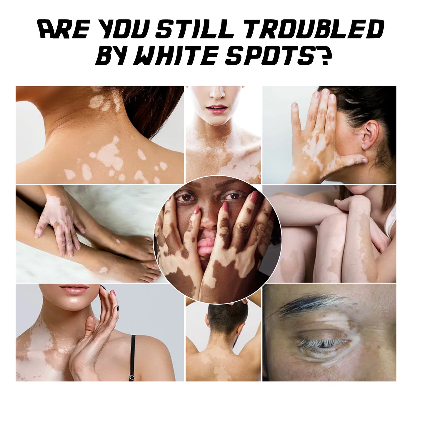 Skin Care Cream Apply Repair Care Cream To The Skin Of The Body, Arms And Legs