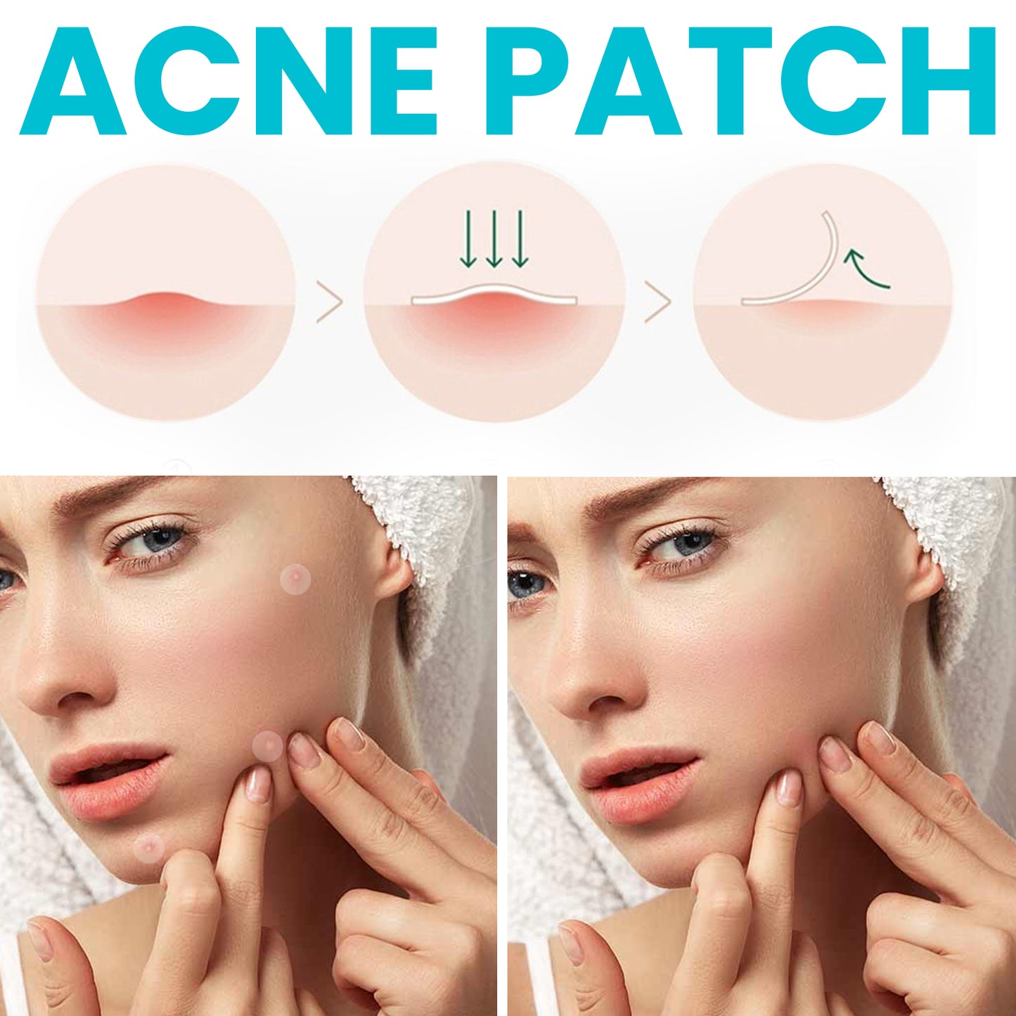 Acne Patch, Repair Facial Acne Invisible Concealer Hydrocolloid Patch