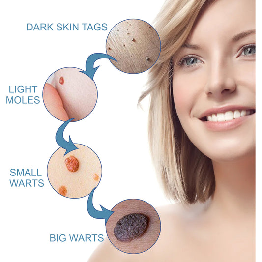 Wart Cream, Skin Clean And Smooth Wart Nevi Facial Care Cream