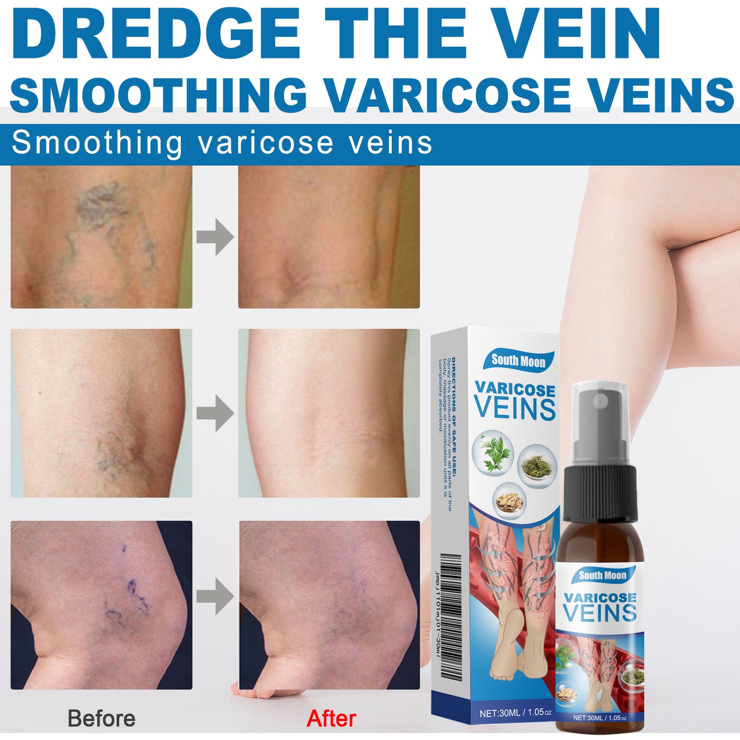Leg Care Spray Gently Relieve Leg Discomfort, Blue Veins And Bumps Repair Daily Care