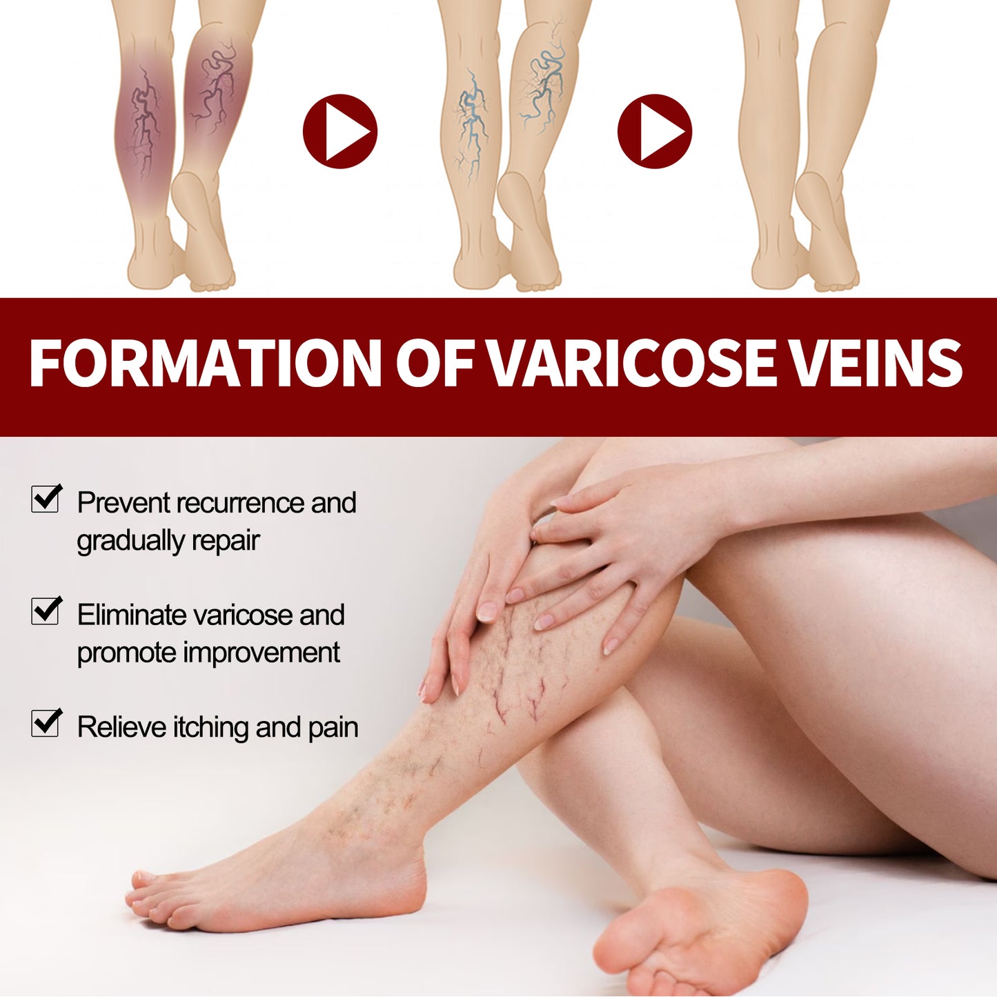 Veinmist Varicose Spray, Relief Sore Legs Massage Earthworm Leg Vein Treatment Spray
