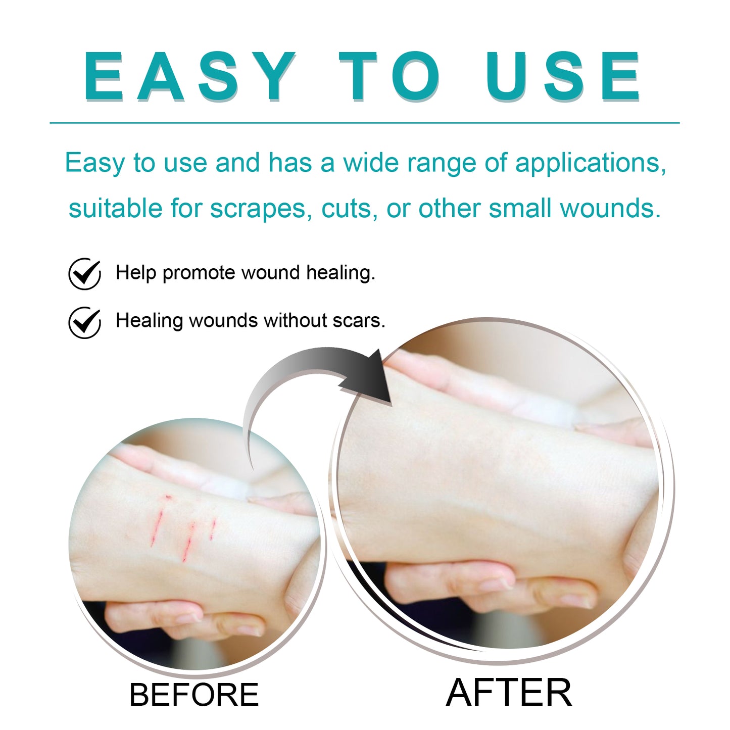 Liquid Bandage Drops Protect Skin Fast Film Formation Breathable Waterproof Skin Repair Drops