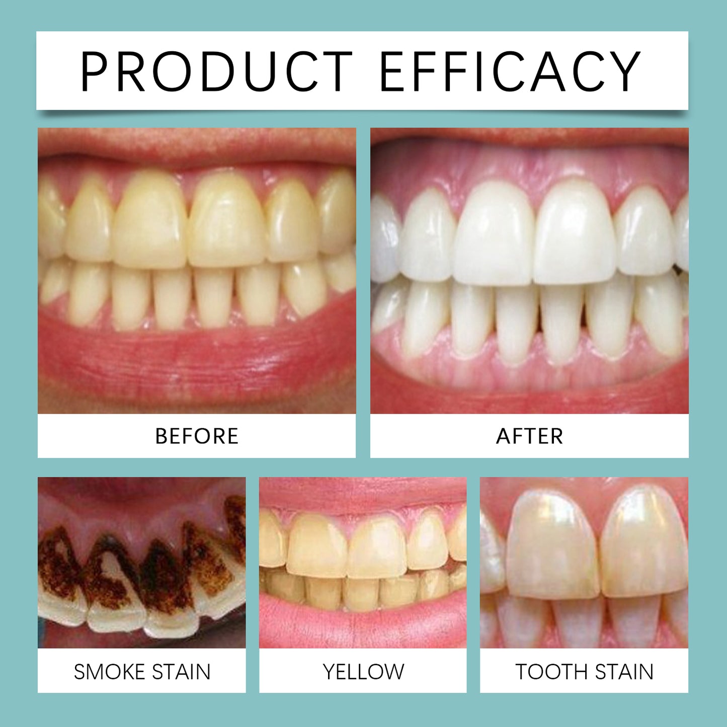 Instant Tooth Whitening Tooth Paint, Clean The Tartar Very Well Dirt Bright White Teeth And Fresh Smell