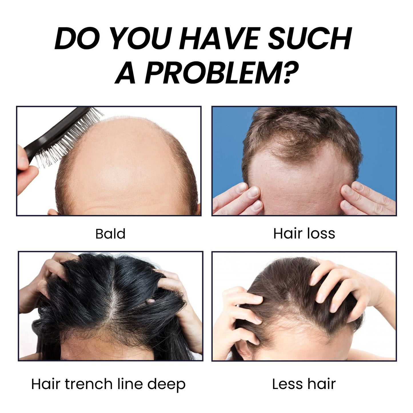 Hair Boost Spray, Ginger Multiflorum Essence Moisturizes Scalp And Prevents Hair Loss