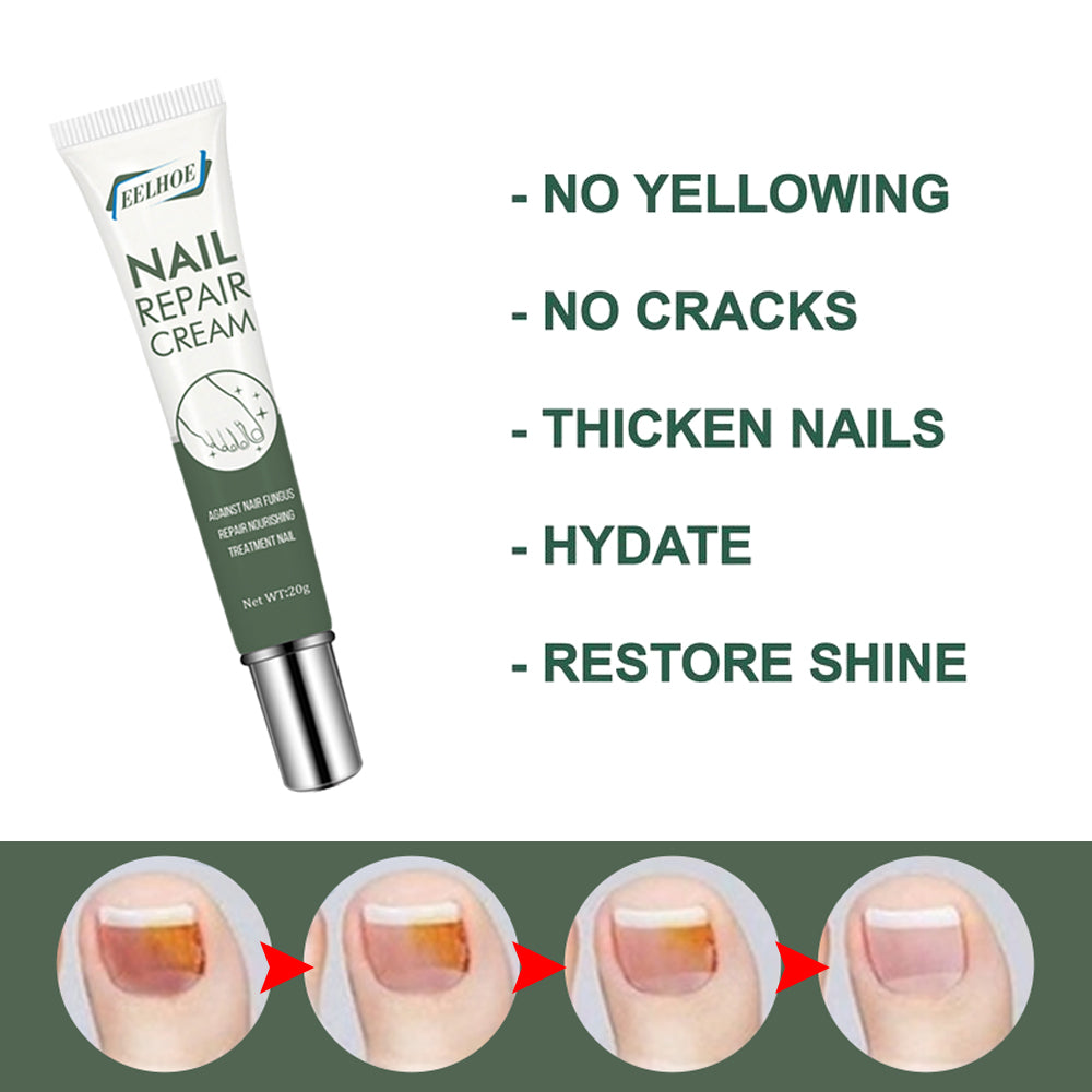 Foot Care And Thickening Nail Repair Cream. Nail Repair Cream