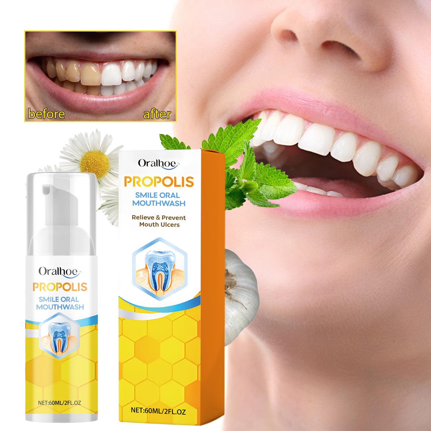 Propolis Oral Cleaning Mousse Oral Cleaning Care Tooth Stain Removal Fresh Mousse Toothpaste