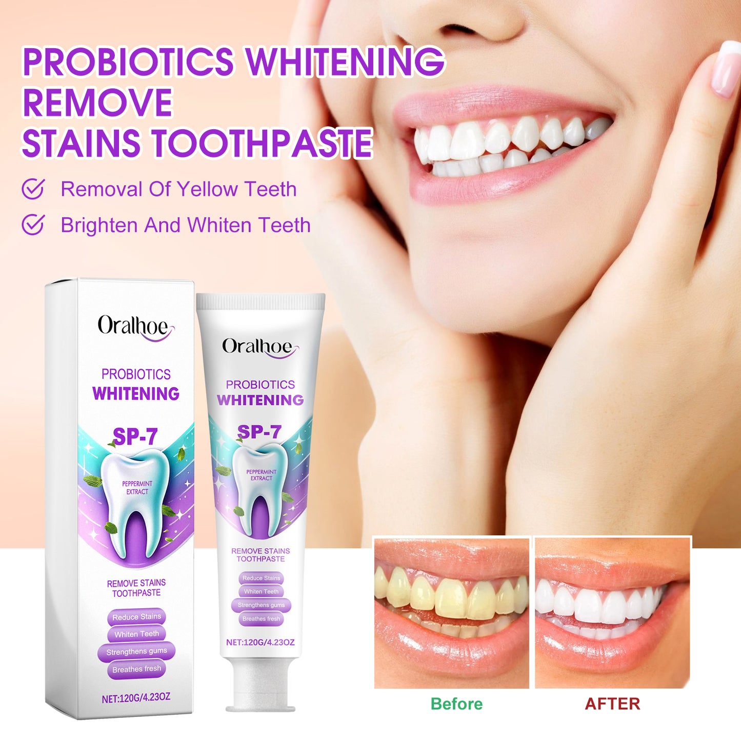 Probiotics Whitening Remove Stains Toothpaste, Dental Care Cleaning Oral Odor Toothstains Tartar Beautifying Teeth Whitening