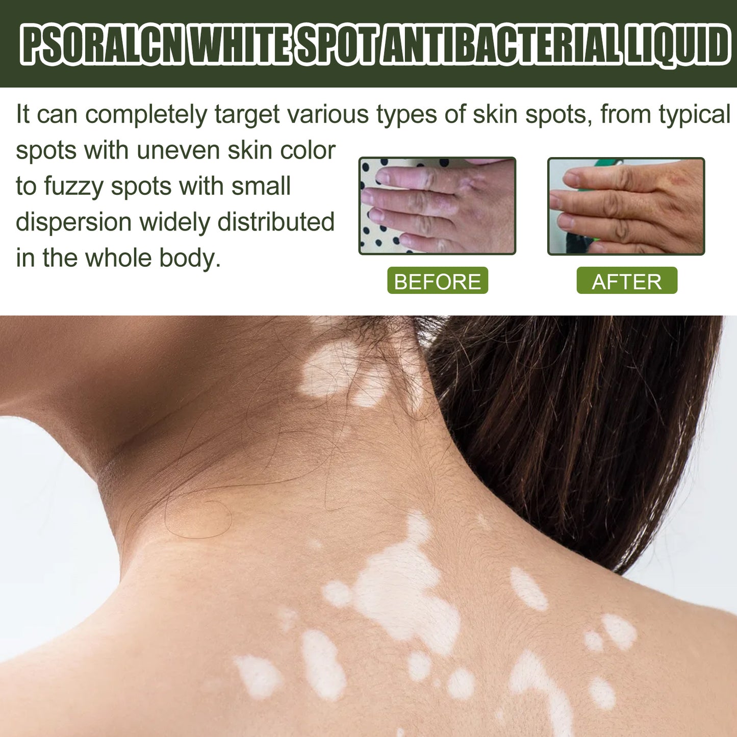 White Spot Purifying Serum For Whitening And Repairing White Spot Spot And Perspiration Spot Skin Moisturizing Serum