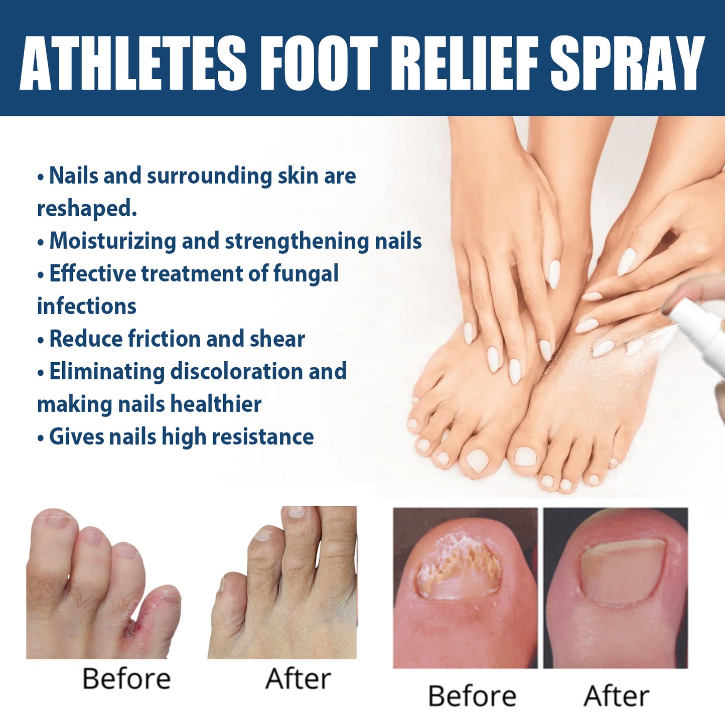 Athletes Foot Relief Spray, Relieve Foot Sweat Foot Itching Peeling Gray Nails Foot Odor Moisturizing Care Spray