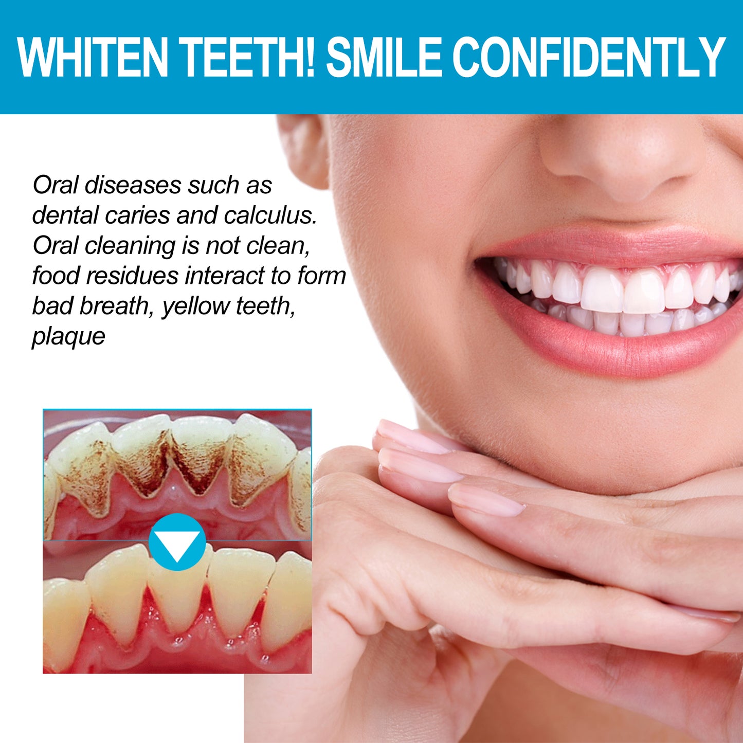 Jelly Cup Mouthwash Cleans Bad Breath, Teeth Stains, Smoke Stains, Brightening Teeth And Refreshing Breath