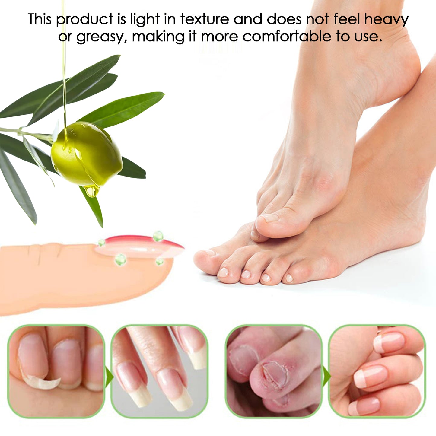 Cuticle Oil Pen, Manicure Moisturizes And Softens Cuticles To Reduce Breakage Thickening Brightening Nails