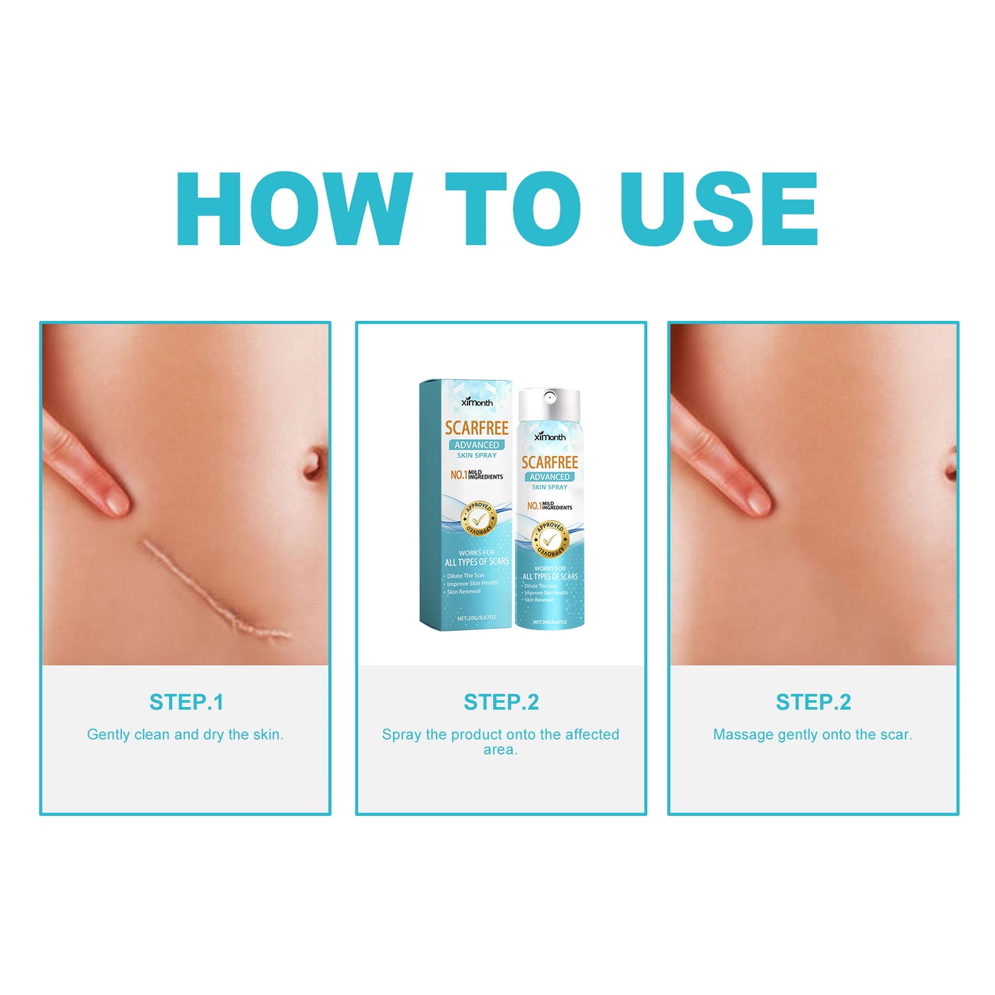 Scarfree Advanced Skin Spray, Body Skin Care Reduces Post-Natal Scars And Smooths Skin