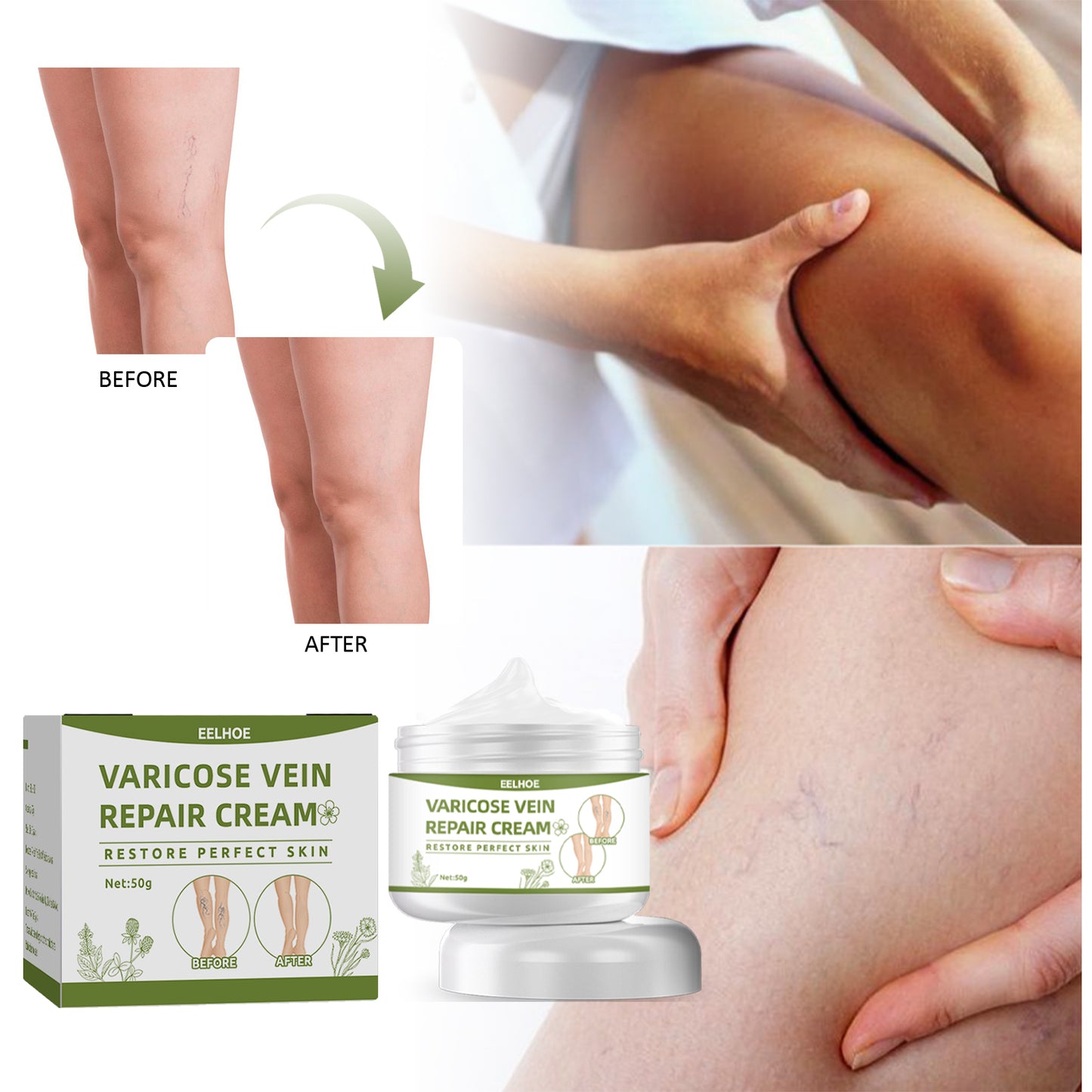 Leg Repair Cream Relieves Leg Discomfort Massage Leg Repair Cream For Raised Veins