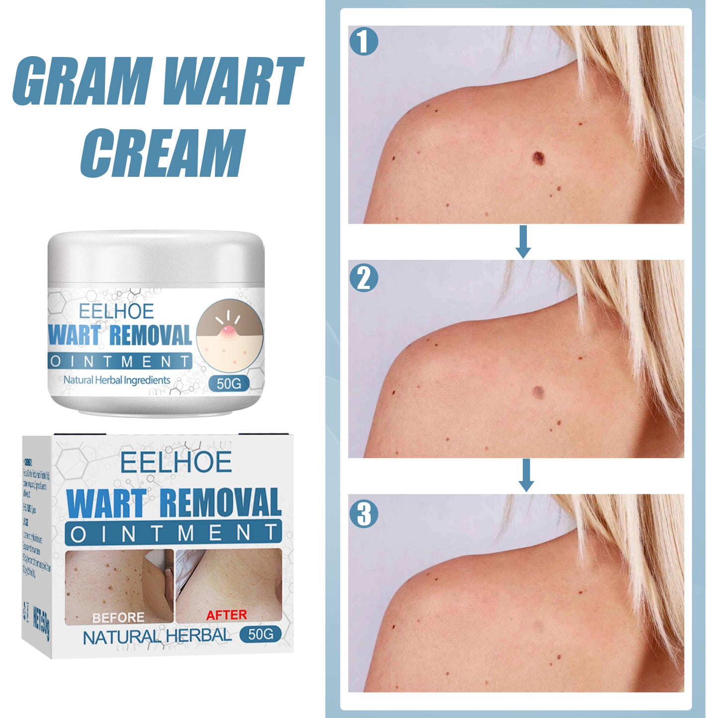 Wart Cream, Skin Clean And Smooth Wart Nevi Facial Care Cream