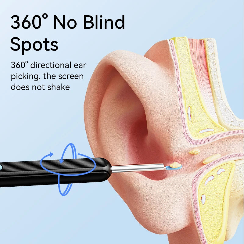 Visual Ear Cleaner with camera Set Ear Wax Removal Otoscope USB C Charging Endoscope Wax Removal Tool Earpick Mini Camera Clean